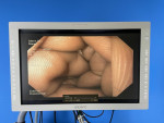Olympus CV180 Video Endoscopy